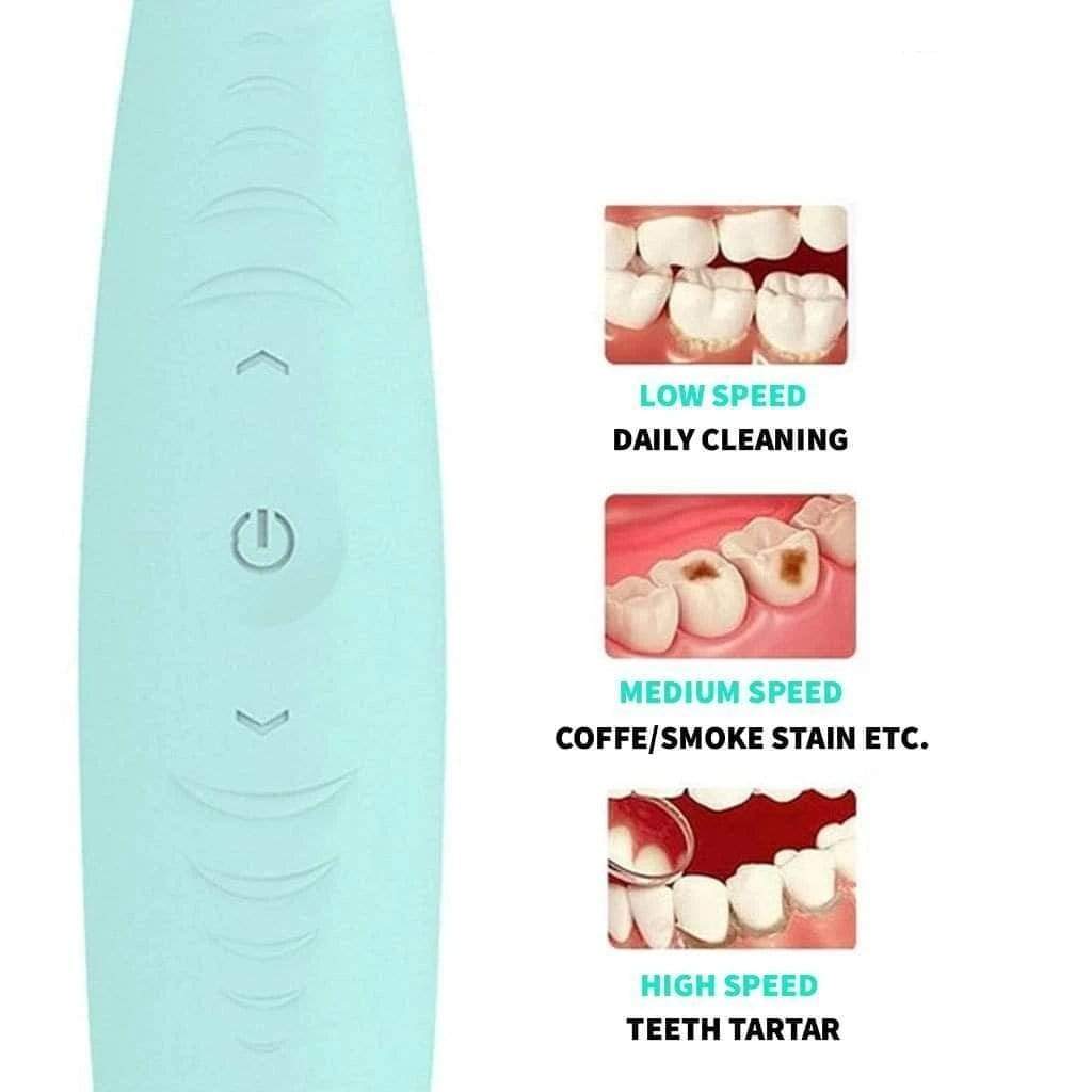 Handsome Store Store Oral Irrigators CleanDental™ Smart Ultrasonic Tooth Cleaner